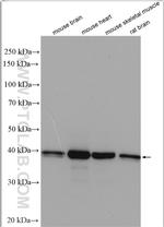 TMOD1 Antibody in Western Blot (WB)