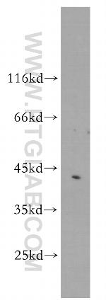 TMOD1 Antibody in Western Blot (WB)