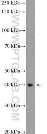 TMOD1 Antibody in Western Blot (WB)