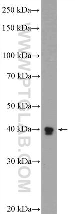 TMOD1 Antibody in Western Blot (WB)
