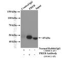 PREB Antibody in Immunoprecipitation (IP)