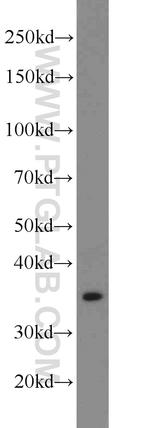 PREB Antibody in Western Blot (WB)