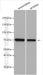 tPA Antibody in Western Blot (WB)