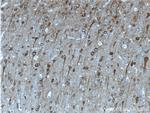 NSE Antibody in Immunohistochemistry (Paraffin) (IHC (P))