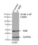 NSE Antibody in Western Blot (WB)