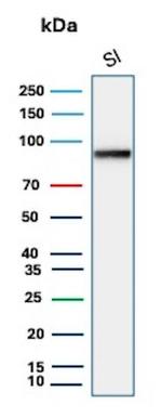 Cadherin 17/LI Cadherin (Gastric Adenocarcinoma Marker) Antibody in Western Blot (WB)