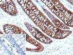 Cadherin 17/LI Cadherin (Gastric Adenocarcinoma Marker) Monoclonal Antibody (CDH17/2612)