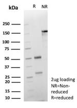 Cadherin 17/LI Cadherin (Gastric Adenocarcinoma Marker) Antibody in SDS-PAGE (SDS-PAGE)