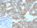 Cadherin 17/LI Cadherin (Gastric Adenocarcinoma Marker) Antibody in Immunohistochemistry (Paraffin) (IHC (P))