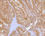 Cadherin 17/LI Cadherin (Gastric Adenocarcinoma Marker) Monoclonal Antibody (CDH17/2613)