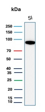 Cadherin 17/LI Cadherin (Gastric Adenocarcinoma Marker) Antibody in Western Blot (WB)