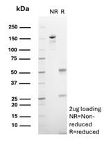 Cadherin 17/LI Cadherin (Gastric Adenocarcinoma Marker) Antibody in SDS-PAGE (SDS-PAGE)