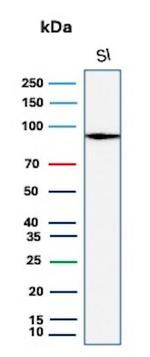 Cadherin 17/LI Cadherin (Gastric Adenocarcinoma Marker) Antibody in Western Blot (WB)