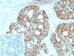 Cadherin 17/LI Cadherin (Gastric Adenocarcinoma Marker) Antibody in Immunohistochemistry (Paraffin) (IHC (P))