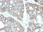 Cadherin 17/LI Cadherin (Liver-Intestine Marker) Monoclonal Antibody (CDH17/2616)