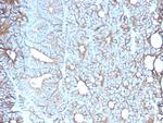 Cadherin 17/LI Cadherin (Liver-Intestine Marker) Monoclonal Antibody (CDH17/2617)