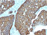 Cadherin 17/LI Cadherin (Liver-Intestine Marker) Monoclonal Antibody (CDH17/2618)