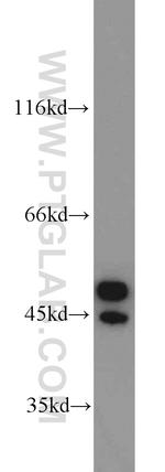 Annexin VII Antibody in Western Blot (WB)