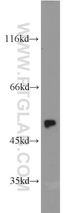 Annexin VII Antibody in Western Blot (WB)