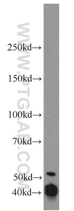 Annexin VII Antibody in Western Blot (WB)