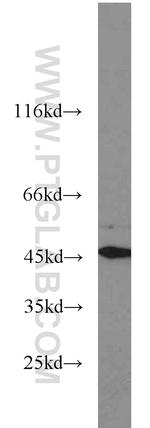 Annexin VII Antibody in Western Blot (WB)