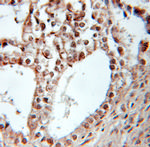 PPARD Antibody in Immunohistochemistry (Paraffin) (IHC (P))