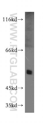 PPARD Antibody in Western Blot (WB)