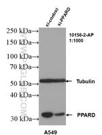 PPARD Antibody in Western Blot (WB)