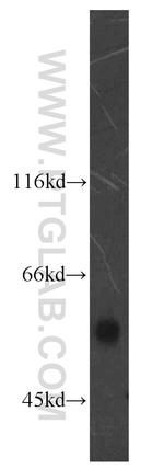PPARD Antibody in Western Blot (WB)