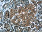 TUSC4 Antibody in Immunohistochemistry (Paraffin) (IHC (P))