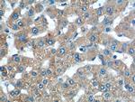 TAOK3 Antibody in Immunohistochemistry (Paraffin) (IHC (P))