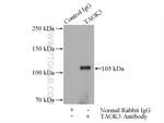 TAOK3 Antibody in Immunoprecipitation (IP)