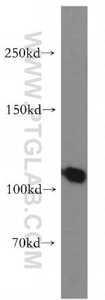 TAOK3 Antibody in Western Blot (WB)