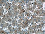 TAOK3 Antibody in Immunohistochemistry (Paraffin) (IHC (P))