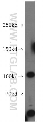 TAOK3 Antibody in Western Blot (WB)