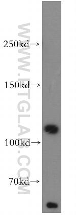 TAOK3 Antibody in Western Blot (WB)