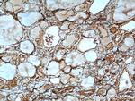 MYCN Antibody in Immunohistochemistry (Paraffin) (IHC (P))