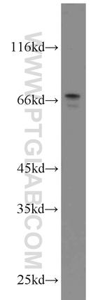 MYCN Antibody in Western Blot (WB)
