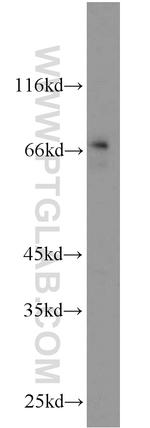 MYCN Antibody in Western Blot (WB)