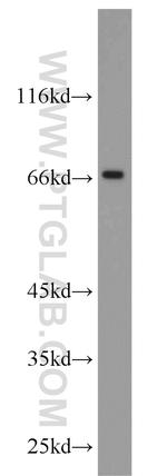 MYCN Antibody in Western Blot (WB)