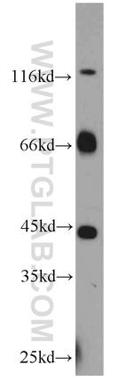 MYCN Antibody in Western Blot (WB)