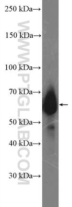 MYCN Antibody in Western Blot (WB)