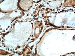 MYCN Antibody in Immunohistochemistry (Paraffin) (IHC (P))