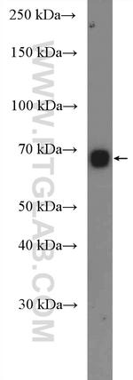 MYCN Antibody in Western Blot (WB)