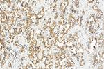 TAP2 Antibody in Immunohistochemistry (Paraffin) (IHC (P))