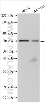 TAP2 Antibody in Western Blot (WB)