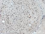 C17orf81 Antibody in Immunohistochemistry (Paraffin) (IHC (P))
