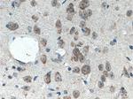 C17orf81 Antibody in Immunohistochemistry (Paraffin) (IHC (P))
