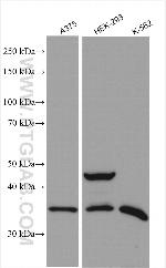 C17orf81 Antibody in Western Blot (WB)