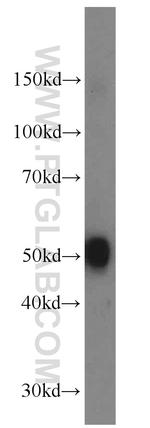 DOPA decarboxylase Antibody in Western Blot (WB)